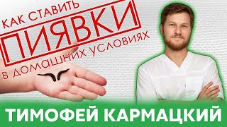 ПИЯВКИ. КАК СТАВИТЬ в домашних условиях!!!
