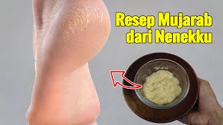 100% MUJARAB! CUKUP PAKAI INI, KAKI PECAHPECAH LENYAP KAKI MULUS SEPERTI SEDIA KALA