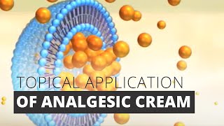 Topical Administration of Analgetics