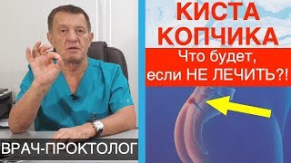 Киста копчика. Что будет если не лечить?