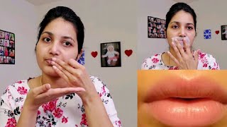 #WinterLipCare పెదవుల పగుళ్ళకు Best Remedy || Get Rid Of Chapped & Dry Lips || Shruthi Diaries