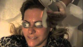 Laser Cosmetica - SMILE for your Photofacial