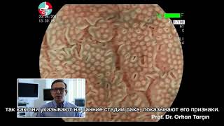 Расширенная эндоскопия-обследование желудка