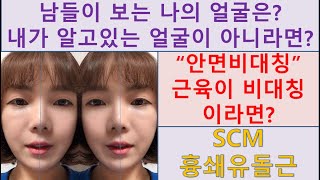 안면비대칭?얼굴이더큰쪽SCM늘리자