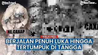 Potret Tumpukan Tubuh Tentara Ukraina yang Ditinggal di Medan Perang