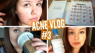 ACNE VLOG 3 | Accutane Update (2 Weeks)