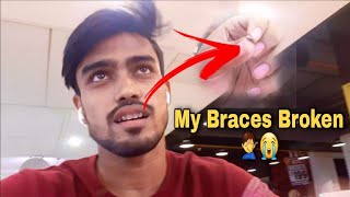 I Accidentally broke My teeth braces ????‍ ️