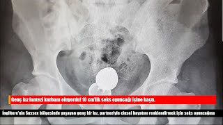 Genç kız fantezi kurbanı oluyordu! 10 cm'lik seks oyuncağı içine kaçtı.