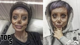 5 Teenagers Who Turned Themselves Into Plastic