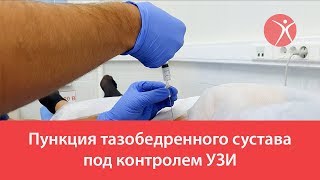 Пункция тазобедренного сустава под контролем УЗИ