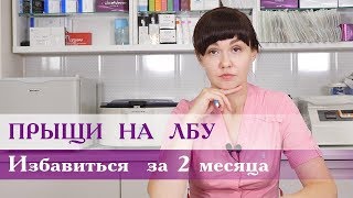 Прыщи на лбу.  Избавьтесь  от прыщей за 2 месяца