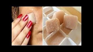 Questo ha rimosso le macchie del mio viso in SOLO 15 minuti È incredibile! | Con patate e limone