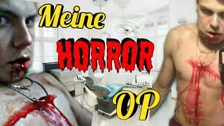 Weisheitszahn OP geht schief !!!!