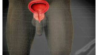 cura cancer de prostata plantas medicinales uriel tapia
