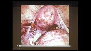 Obstetrics, Gynaecology and Paediatrics Imaging - TAS Branch Nov 2016 Meeting Part 9