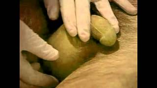 EXAM CANCER - How to do better in your exams Genitalia, Male Rectum and Hernias