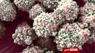 هل تحصل على احتياجاتك من فيتامين د؟