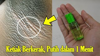 CUMA 1 MENIT, AREA HITAM DI BADANMU KEMBALI PUTIH BERSIH SECARA ALAMI