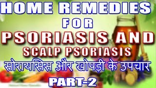Home Remedies For Psoriasis & Scalp Psoriasis Part 2 II सोरायसिस & खोपड़ी सोरायसिस - उपचार भाग-2