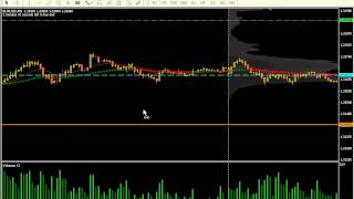 This is how to trade profitably. (Diary 26)