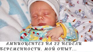 Амниоцентез в МОНИИАГ. Кисты сосудистых сплетений. Маленькая носовая кость плода.