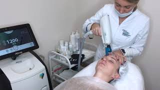 Лазерное 4 D омоложение Clear Lift