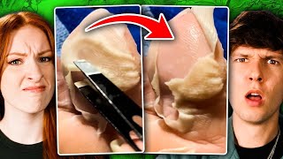 Don't Look Away - Most Disgusting Videos On The Internet! | React