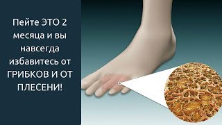 Пейте ЭТО 2 месяца и вы навсегда избавитесь от ГРИБКОВ И ОТ ПЛЕСЕНИ!