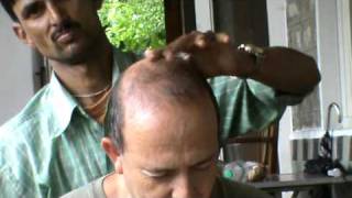Head Massage in India 2010 עיסוי ראש בהודו