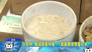 20171229中天新聞　台首例！　腸道菌叢移植　11歲童糞便救重症弟