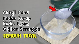 TAK USAH PAKAI OBAT! BEGINI CARA MENYEMBUHKAN GATAL DI KULIT SECARA ALAMI, 100% AMPUH 