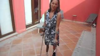 AKBK amputee Walking with arm crutches only