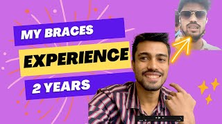 My 2 Years Braces Treatment experience and cost || It really works for you?