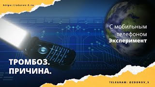 ТРОМБОЗ, причина. Защита от тромбоза