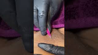 Waxing extractions