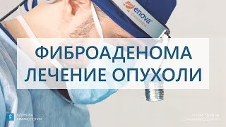 Фиброаденома.  Удаление опухоли.