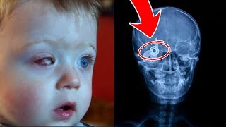 ТОП 5 САМЫХ СТРАШНЫХ НОВЫХ СПИННЕР ТРАВМ |  TOP 5 THE MOST TERRIBLE NEW SPINNER INJURIES