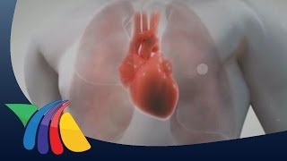 ¿Qué es la hipertensión pulmonar?