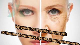 Ирунин от грибка ногтей: отзывы больных, цена, как применять