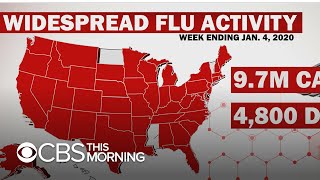 Flu season: Nearly 10 million sickened so far