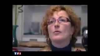 Catherine RHD amputee onelegged woman
