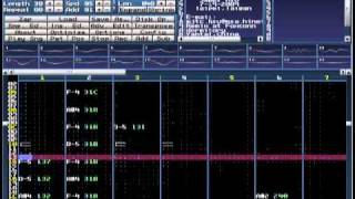 Courage (Remix, Milkytracker)