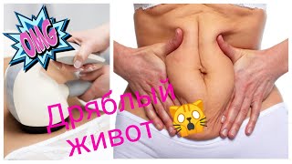 АППАРАТНАЯ КОСМЕТОЛОГИЯ ПРИ ПОХУДЕНИИ / КАК УБРАТЬ РАСТЯЖКИ / LPG МАССАЖ / МИОСТИМУЛЯЦИЯ