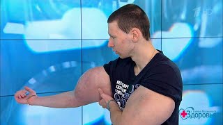 Здоровье. «Руки-базуки». Как помочь Кириллу Терешину? 09.09.2018