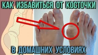 Купить Препарат Orthofix