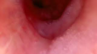 flexible net 20170706 1708190
