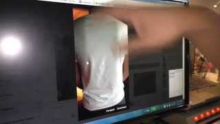 1150 Luo dong spiritual massage picture hands back pain 照片治療手和背疼痛