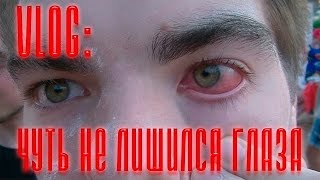 VLOG: Чуть не лишился глаза