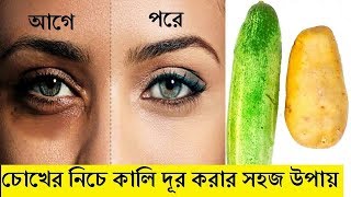চোখের নিচে কালো দাগ দূর করার ঘরোয়া উপায় | Dark Circles Remove | Afroza Parveen