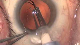 SEELENS HP - Dr. Savaresi